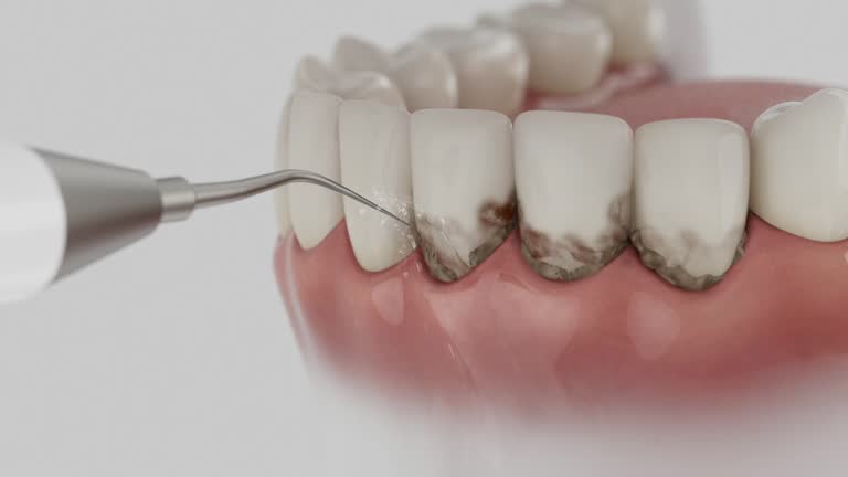 Reliable Dental contractor in Squirrel Mountain Valley, CA by Dentist Open Now